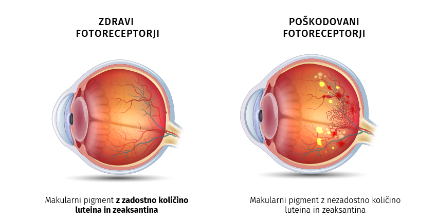 Eye PROtect 1+1 GRATIS